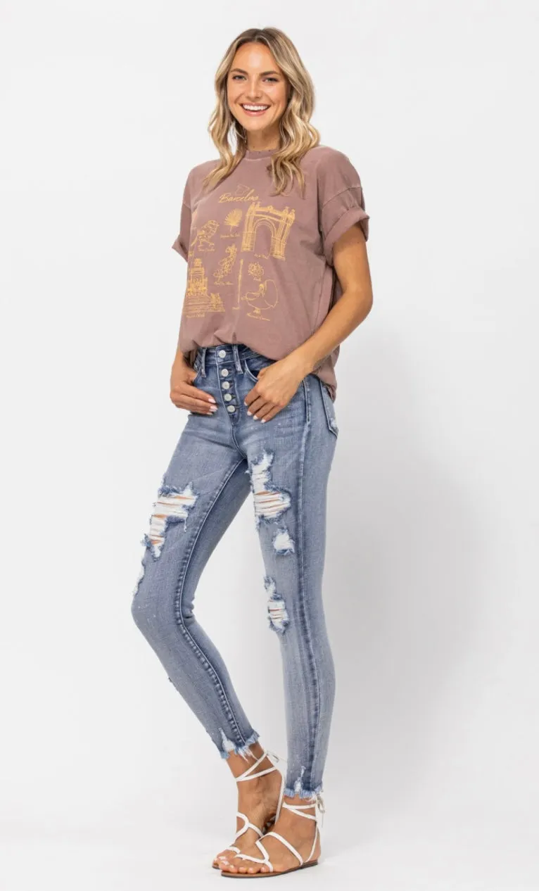 Button-fly Skinnies